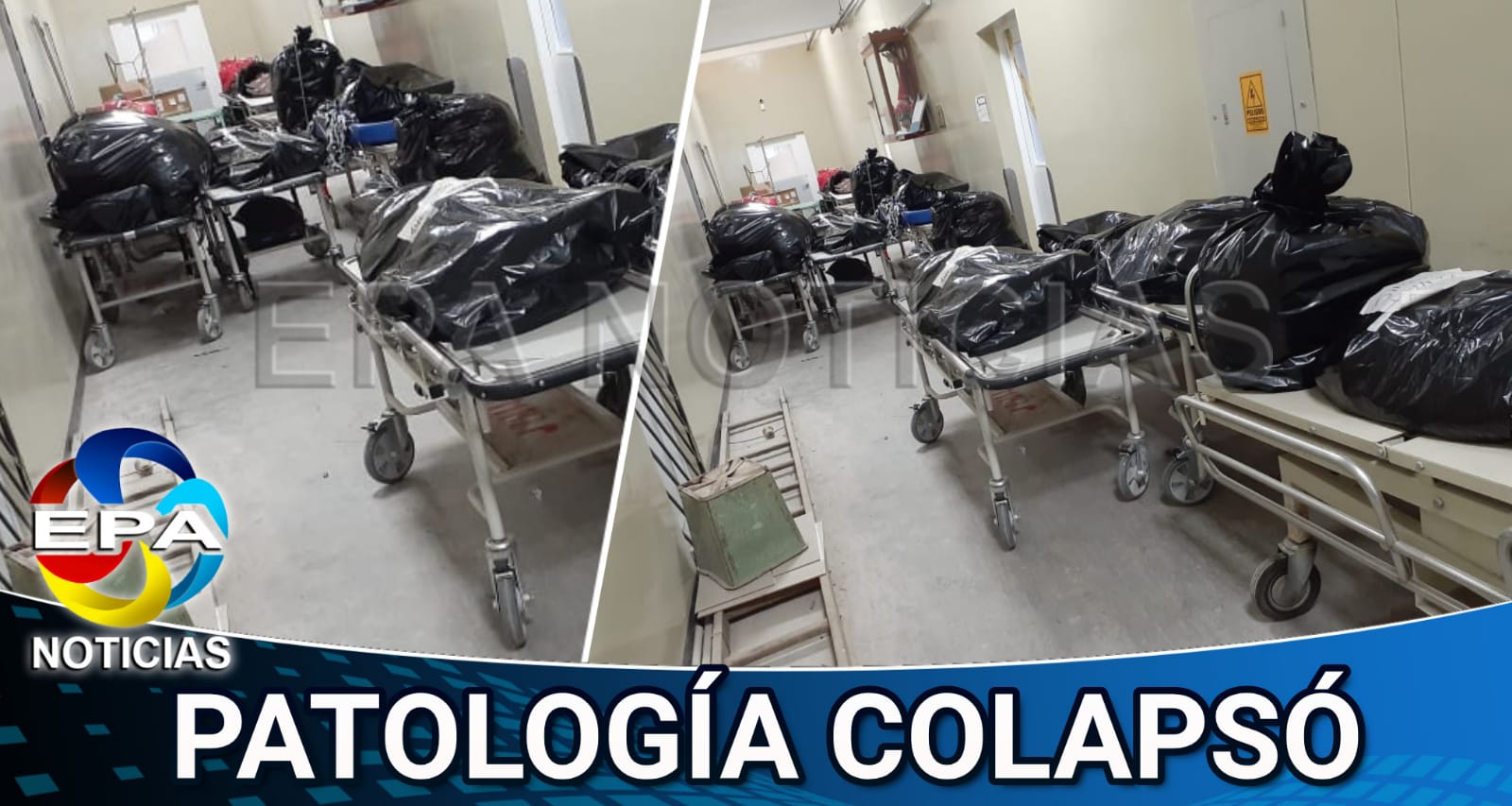 Arequipa. Patología del hospital Covid-19 colapsó.
